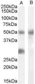 Anti-IGFBP3 antibody, Internal used in Western Blot (WB). GTX88951