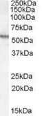 Anti-Arylsulfatase A antibody, Internal used in Western Blot (WB). GTX88953