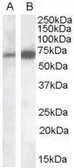 Anti-CADM4 antibody, Internal used in Western Blot (WB). GTX88956