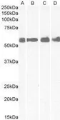 Anti-CRHR1 (aa 107 - 117) antibody, Internal used in Western Blot (WB). GTX88961