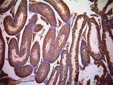 Anti-Lactate Dehydrogenase C (aa 217 - 231) antibody, Internal used in IHC (Paraffin sections) (IHC-P). GTX88966