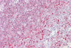 Anti-TPD52 antibody, C-term used in IHC (Paraffin sections) (IHC-P). GTX88974