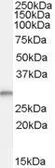 Anti-TPD52L2 antibody, C-term used in Western Blot (WB). GTX88975