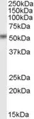 Anti-STEAP4 antibody, C-term used in Western Blot (WB). GTX88989