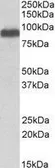 Anti-ITCH antibody, Internal used in Western Blot (WB). GTX88991