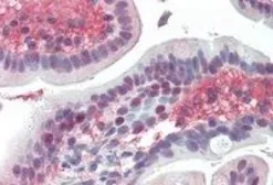 Anti-EGR2 antibody, Internal used in IHC (Paraffin sections) (IHC-P). GTX88998
