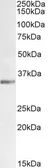 Anti-Lactate Dehydrogenase C (aa 221 - 233) antibody, Internal used in Western Blot (WB). GTX89002