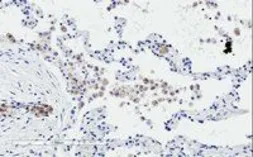 Anti-TREM2 antibody, C-term used in IHC (Paraffin sections) (IHC-P). GTX89017