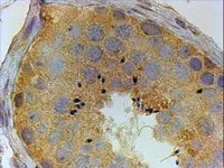 Anti-PIWIL1 antibody, Internal used in IHC (Paraffin sections) (IHC-P). GTX89021