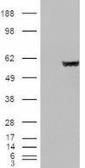 Anti-Fumarate hydratase antibody, Internal used in Western Blot (WB). GTX89022