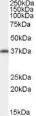 Anti-ARA9 antibody, C-term used in Western Blot (WB). GTX89023