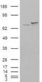 Anti-Ku70 antibody, N-term used in Western Blot (WB). GTX89026