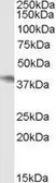 Anti-NCF4 antibody, Internal used in Western Blot (WB). GTX89030