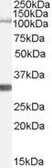 Anti-IDE antibody, Internal used in Western Blot (WB). GTX89032