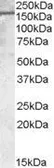 Anti-PODXL antibody, C-term used in Western Blot (WB). GTX89038