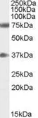Anti-NRG3 antibody, C-term used in Western Blot (WB). GTX89047