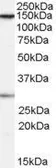 Anti-SUPT16H antibody, Internal used in Western Blot (WB). GTX89051