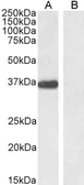 Anti-PTF1A antibody, Internal used in Western Blot (WB). GTX89052