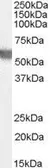 Anti-G6PD (aa 308 - 320) antibody, Internal used in Western Blot (WB). GTX89057