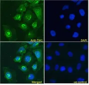 Anti-TIA1 antibody, Internal used in Immunocytochemistry/ Immunofluorescence (ICC/IF). GTX89059
