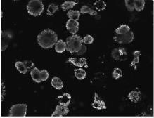 Anti-Perilipin 1 antibody, C-term used in Immunocytochemistry/ Immunofluorescence (ICC/IF). GTX89060
