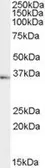Anti-Neurokinin 1 Receptor antibody, Internal used in Western Blot (WB). GTX89067