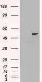 Anti-PAX8 antibody, Internal used in Western Blot (WB). GTX89084