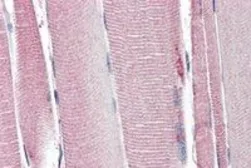 Anti-UCP2 antibody, Internal used in IHC (Paraffin sections) (IHC-P). GTX89094
