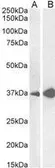 Anti-Arginase 1 antibody, C-term used in Western Blot (WB). GTX89099
