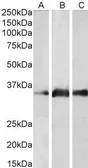 Anti-Kallikrein 5 antibody, Internal used in Western Blot (WB). GTX89113