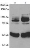 Anti-APPL1 antibody, Internal used in Western Blot (WB). GTX89127