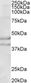 Anti-NPY2R antibody, Internal used in Western Blot (WB). GTX89129