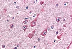 Anti-O-GlcNAc transferase antibody, Internal used in IHC (Paraffin sections) (IHC-P). GTX89131