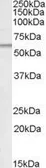 Anti-ATGL antibody, Internal used in Western Blot (WB). GTX89133