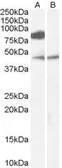 Anti-ZDHHC8 antibody, Internal used in Western Blot (WB). GTX89139