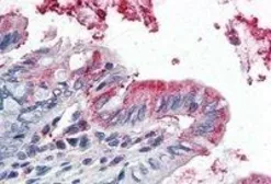 Anti-GPX3 antibody, Internal used in IHC (Paraffin sections) (IHC-P). GTX89142