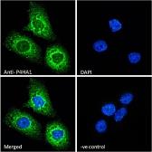 Anti-P4HA1 antibody, Internal used in Immunocytochemistry/ Immunofluorescence (ICC/IF). GTX89145