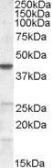 Anti-ABHD5 antibody, Internal used in Western Blot (WB). GTX89147