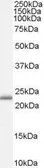 Anti-RBP4 antibody, Internal used in Western Blot (WB). GTX89148