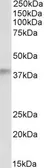 Anti-ADH5 antibody, Internal used in Western Blot (WB). GTX89162