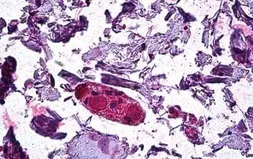 Anti-DGAT1 antibody, Internal used in IHC (Paraffin sections) (IHC-P). GTX89164