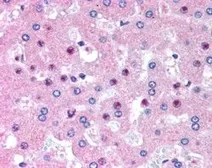 Anti-C14orf68 (aa242-254) antibody, Internal used in IHC (Paraffin sections) (IHC-P). GTX89170