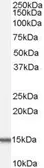 Anti-ACYP1 (isoform a) antibody, Internal used in Western Blot (WB). GTX89173