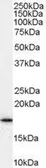 Anti-ARF1 antibody, C-term used in Western Blot (WB). GTX89179