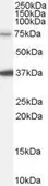 Anti-NEDD1 antibody, Internal used in Western Blot (WB). GTX89186