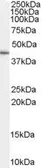 Anti-GATA5 antibody, Internal used in Western Blot (WB). GTX89189