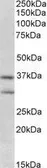 Anti-FGF23 antibody, Internal used in Western Blot (WB). GTX89195