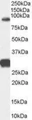 Anti-FOXP2 antibody, Internal used in Western Blot (WB). GTX89199