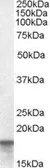 Anti-Anterior Gradient 2 antibody, Internal used in Western Blot (WB). GTX89217