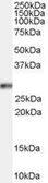 Anti-HOXB13 antibody, C-term used in Western Blot (WB). GTX89223